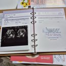 또리와 아로 | 《임신기록》37주 임신 일기, 천안 퀸스 정기 진료, 분만 상담(제대혈 설명들음)