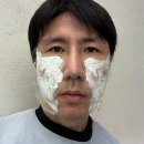 진피부과 | 명동 피부과 실리프팅 팔자주름 심부볼 좋아진 후기