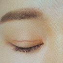 바르다성형외과의원 네이버블로그