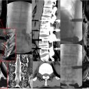 OPD MEDICAL 이미지