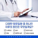 치루개 이미지