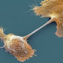 부작용 없이 전이성 췌장암을 치료하는 면역 항암 신약 “IMM-101” 이미지