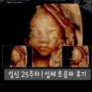 인천우리병원 | [임신일기] 인천 아인병원 임신 25주 임당검사 후기 + 입체 초음파 비용 | 우리 만두 얼굴 첫 공개(챗...