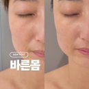 바른몸 - 서구 | 바른몸