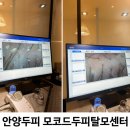 안양두피 모코드두피탈모센터 프리미엄 탈모두피관리