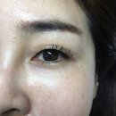 인애네일