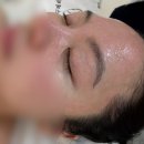 서현1동 소로2 | [분당 피부관리] 서현역 &#34;오직 에스테틱&#34;에서 모공축소와 리프팅을 위해 받은 스킨부스터 관리 후기