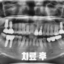 고운가이드치과병원 이미지