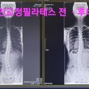 RBT체형교정운동센터 이미지