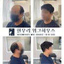 목동家 | 남자 부분가발 시술 후기 &#34;가발도 디자인이다!&#34;