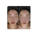 창원 얼굴경락 손길에반하다