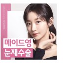 메이드영성형외과 쌍꺼풀재수술 후기 맘에 들어요!