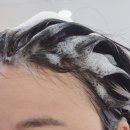 두피탈모태후사랑무전점 이미지