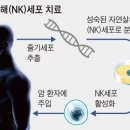 암 정복하는 NK세포 치료제, 세계 최초로 상업화 성공하나 이미지