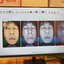 영통피부관리 애띠애 // 진짜 제대로된 관리를 받고 싶다면 바로 수원피부관리 애띠애
