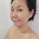 대전 하이푸 리프팅후기 미모다뷰티 얼굴윤곽관리