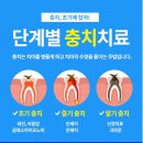오후치과 이미지