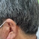 전주세계보청기 청각장애인 보청기 처방전 받고 보청기 구입한 후기 이미지