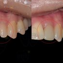 정선치과기공소 이미지