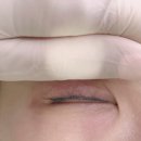 대건메디칼 | 무통증 강남아이라인반영구 투엠메이크업 추천후기