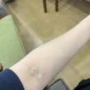 149 | 대전서울여성병원 임당재검후기(수치 149) 이후 저혈당