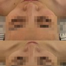 정인안전 | 수성구피부관리_정인에스테틱 방문후기(더운 여름 피부관리맛집)