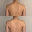 건강미 피부관리 | [잠실 다이어트 피부관리 후기] 건강미 스파 백앤림프 순환관리