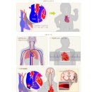 장해출생보장 특별약관[보험기간은 보통약관의 보험기간에도 불구하고 계약일부터 1년] 이미지