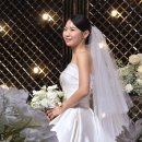 팔사포차 | 결혼준비 팔 모공각화증 알라딘필링 내돈내산 후기(전/후 사진O)