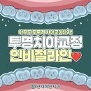 영운 상209호(비40) | 평촌역치과 초등 인비절라인 교정 시작 비용