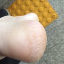 랑구네일