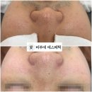 피부애 이미지