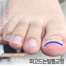 메디컬풋케어 동성제약 풀리메디 청주서원대리점