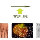 아토피(Atopic Dermatitis)란? 이미지