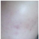 오일스팟 이미지