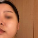 [이천/하이미]깔끔한 피부관리샵_합리적이고 실력있는 이천 에스테틱