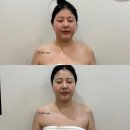 (주)엠피케어텍 | 대구웨딩케어 더에스테틱수미원 대구달서구점에서 페이스 윤곽 큐라젯 받은 후기