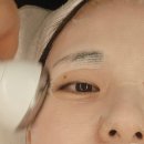 상동교차로 | 부천 온에스테틱 고주파리프팅 종류, 효과, 가격! 상동 피부관리
