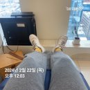 스마일뷰치과의원 | 스마일 뷰 치과 부분교정 내 돈 내산 후기