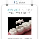 세라믹치과기공소 이미지