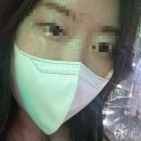 가루개로 | 편평사마귀와의 긴싸움 1탄/치료방법/내돈내산 해본노력들/없애는과정/레이저/실면도
