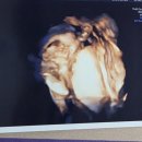 남중동-24 | 임신 22주차, 입체초음파 후기(익산 제일산부인과 정밀초음파)