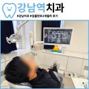 강남역치과 임플란트 완성후기