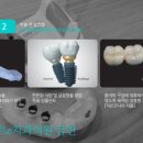 올바른약속치과 네이버블로그