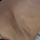 시연피아 | 시연피아 왁싱 멜라닌케어 후기
