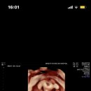 밝은미래산후조리원 이미지