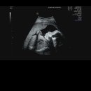 웅촌면보건지소 이미지