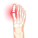 척메디칼 이미지