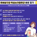 일본 전염병 연쇄상 독성 쇼크 증후군 STSS 나이 원인 이미지