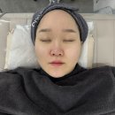 제이우뷰티 | 대구 달서구에스테틱 제이우에스테틱에서 속건조 해결 및 물광피부 후기